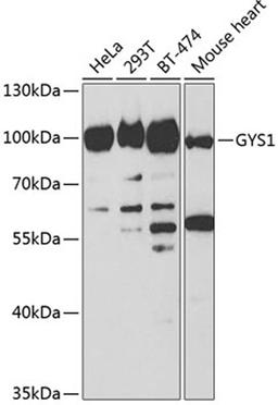 Western blot - GYS1 antibody (A2519)