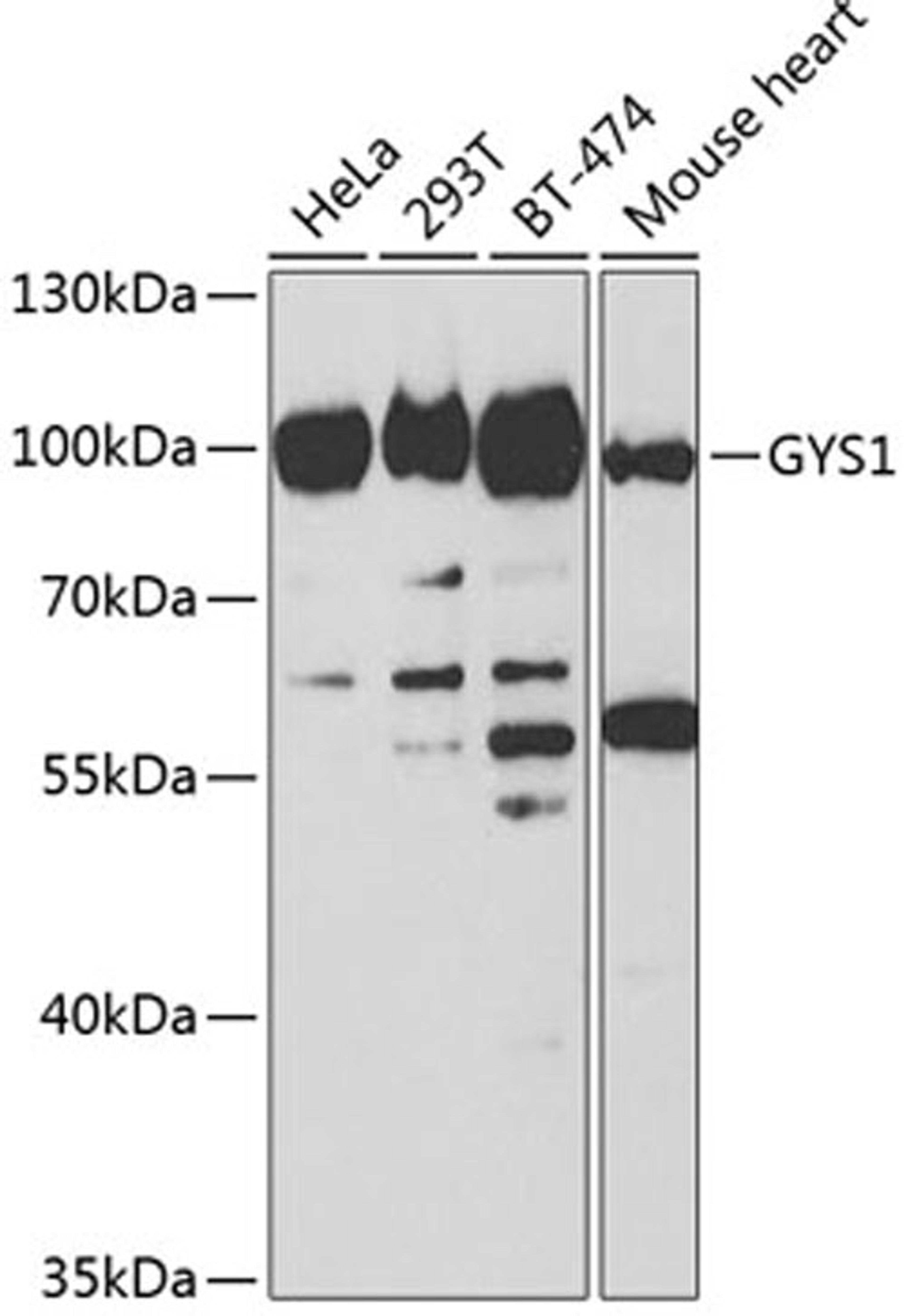 Western blot - GYS1 antibody (A2519)