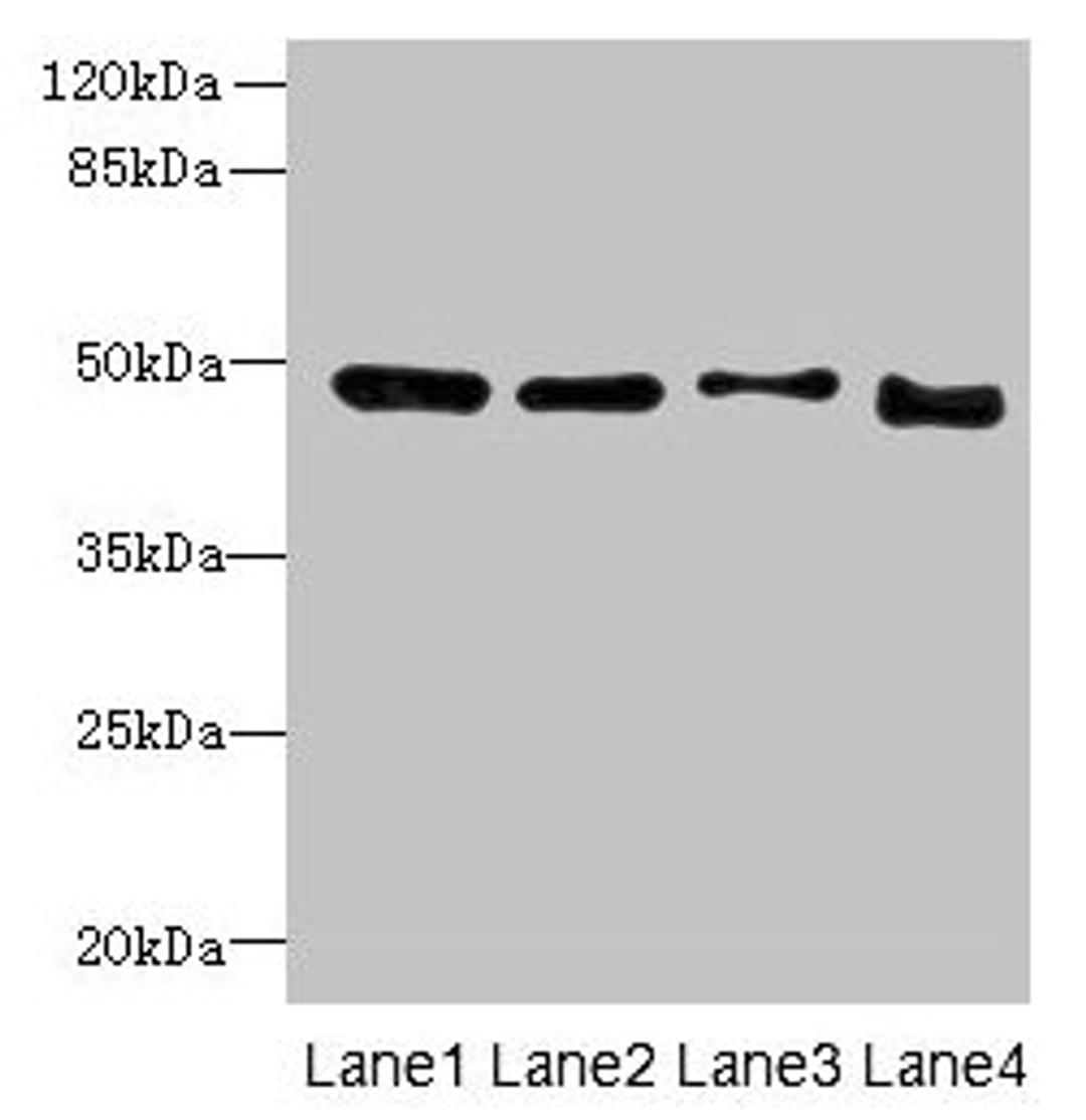 Western blot. All lanes: DDI2 antibody at 4µg/ml. Lane 1: A431 whole cell lysate. Lane 2: HL60 whole cell lysate. Lane 3: K562 whole cell lysate. Lane 4: Caco-2 whole cell lysate. Secondary. Goat polyclonal to rabbit IgG at 1/10000 dilution. Predicted band size: 45, 24, 47 kDa. Observed band size: 47 kDa
