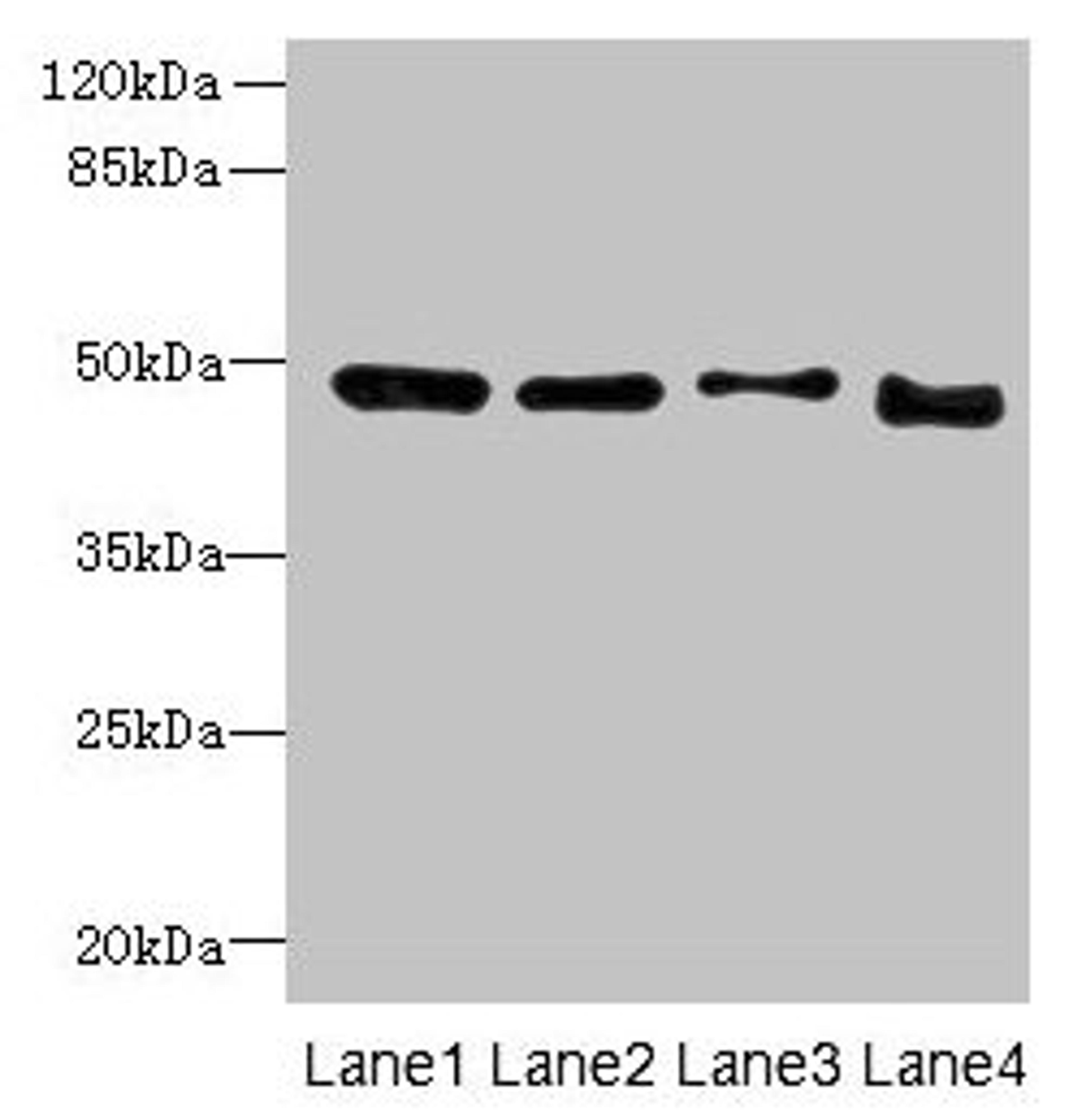 Western blot. All lanes: DDI2 antibody at 4µg/ml. Lane 1: A431 whole cell lysate. Lane 2: HL60 whole cell lysate. Lane 3: K562 whole cell lysate. Lane 4: Caco-2 whole cell lysate. Secondary. Goat polyclonal to rabbit IgG at 1/10000 dilution. Predicted band size: 45, 24, 47 kDa. Observed band size: 47 kDa