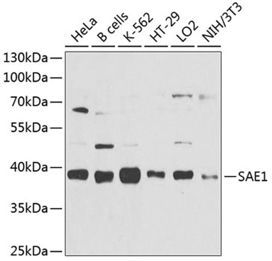 Western blot - SAE1 antibody (A9960)