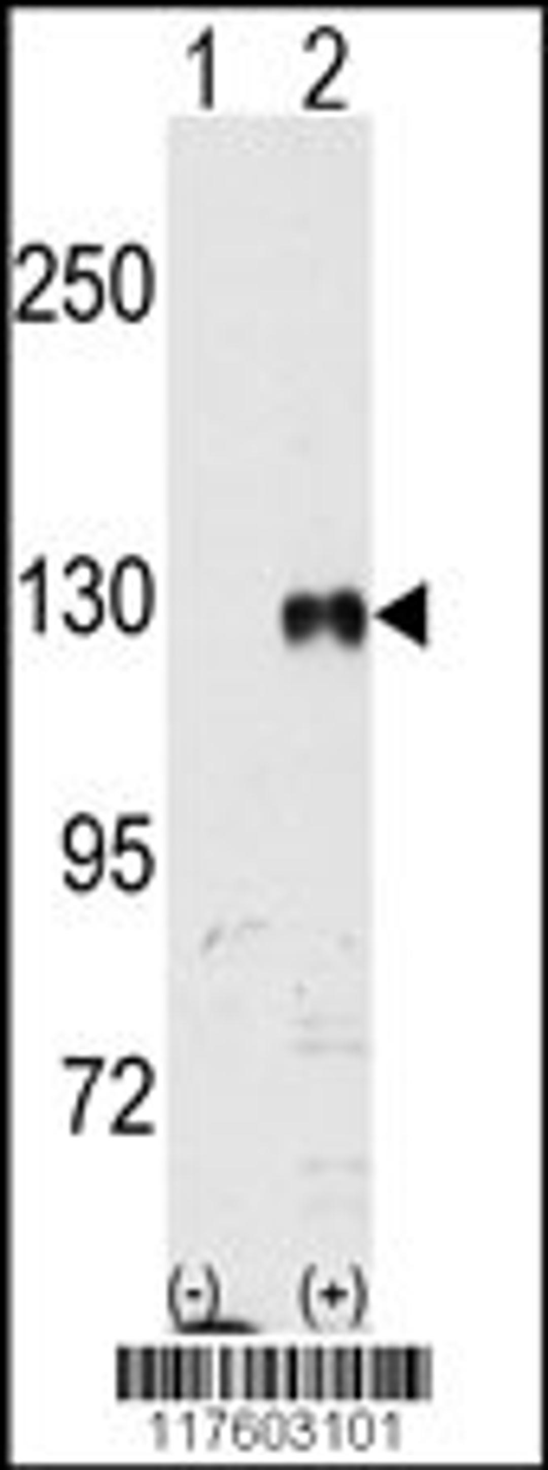 Western blot analysis of EphB1 using rabbit polyclonal EphB1 Antibody 293 cell lysates (2 ug/lane) either nontransfected (Lane 1) or transiently transfected with the EphB1 gene (Lane 2).