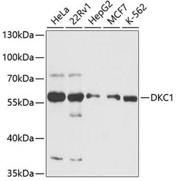 Western blot - DKC1 antibody (A12914)