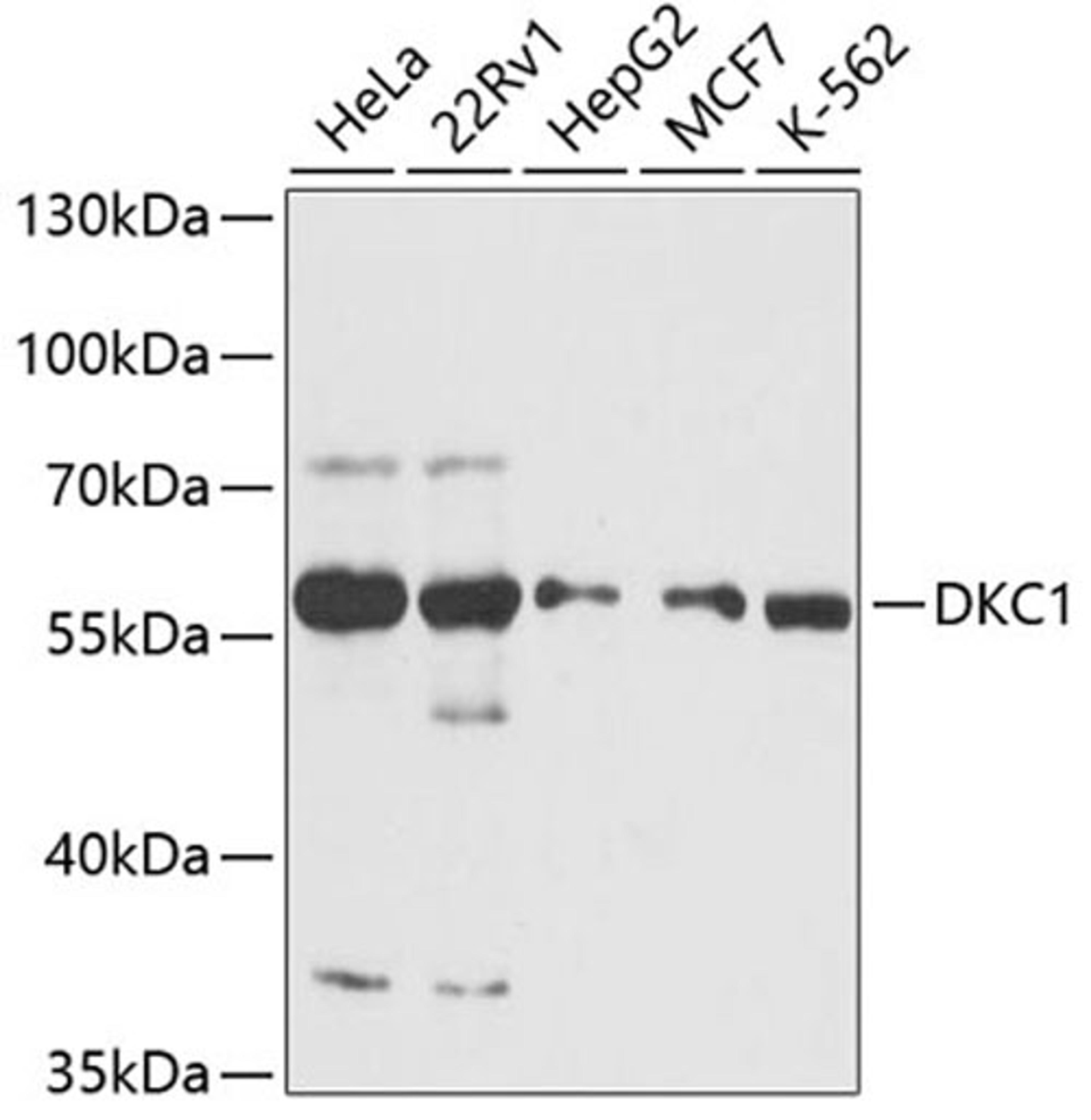 Western blot - DKC1 antibody (A12914)