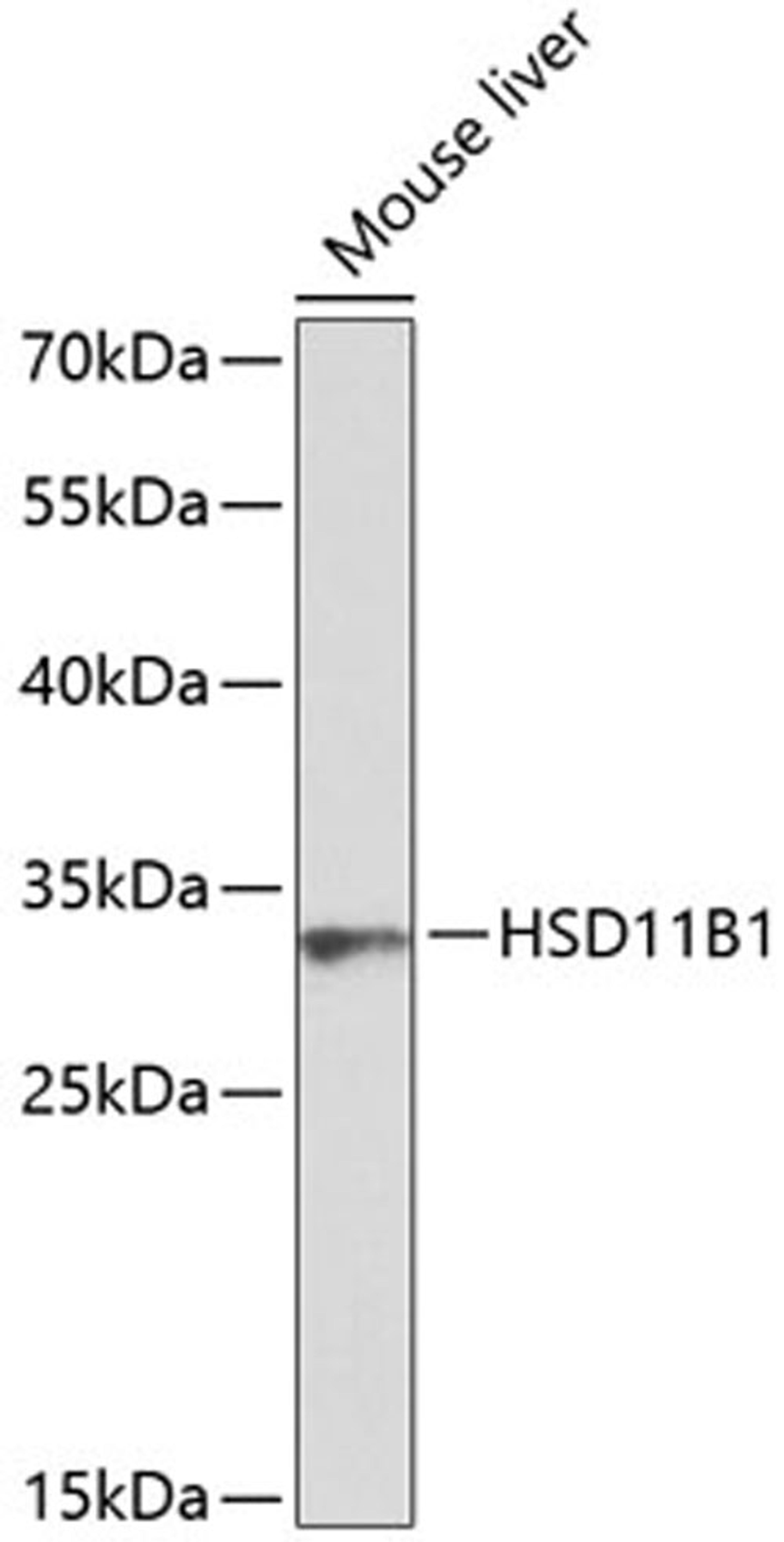 Western blot - HSD11B1 antibody (A1619)