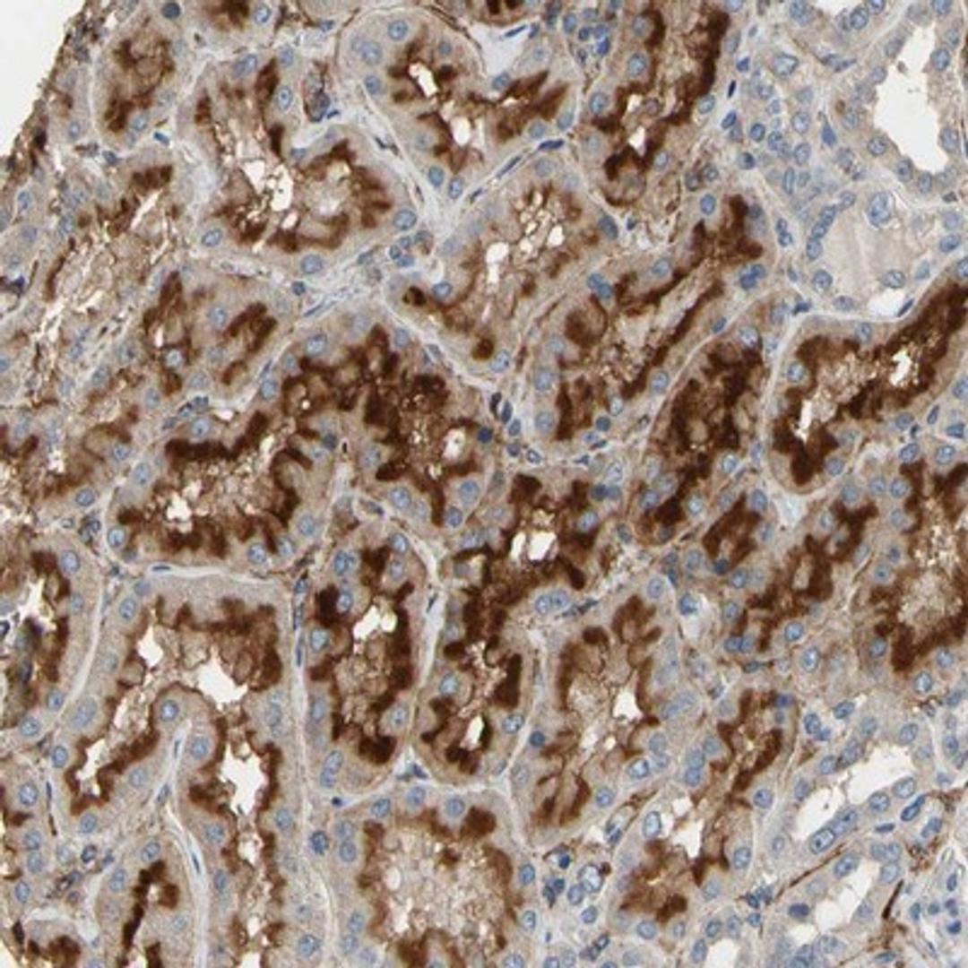 Immunohistochemistry-Paraffin: SUSD2 Antibody [NBP1-88589] - Staining of human kidney shows strong cytoplasmic and membranous positivity in cells in tubules.