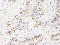 Detection of human UBE1 by immunohistochemistry.