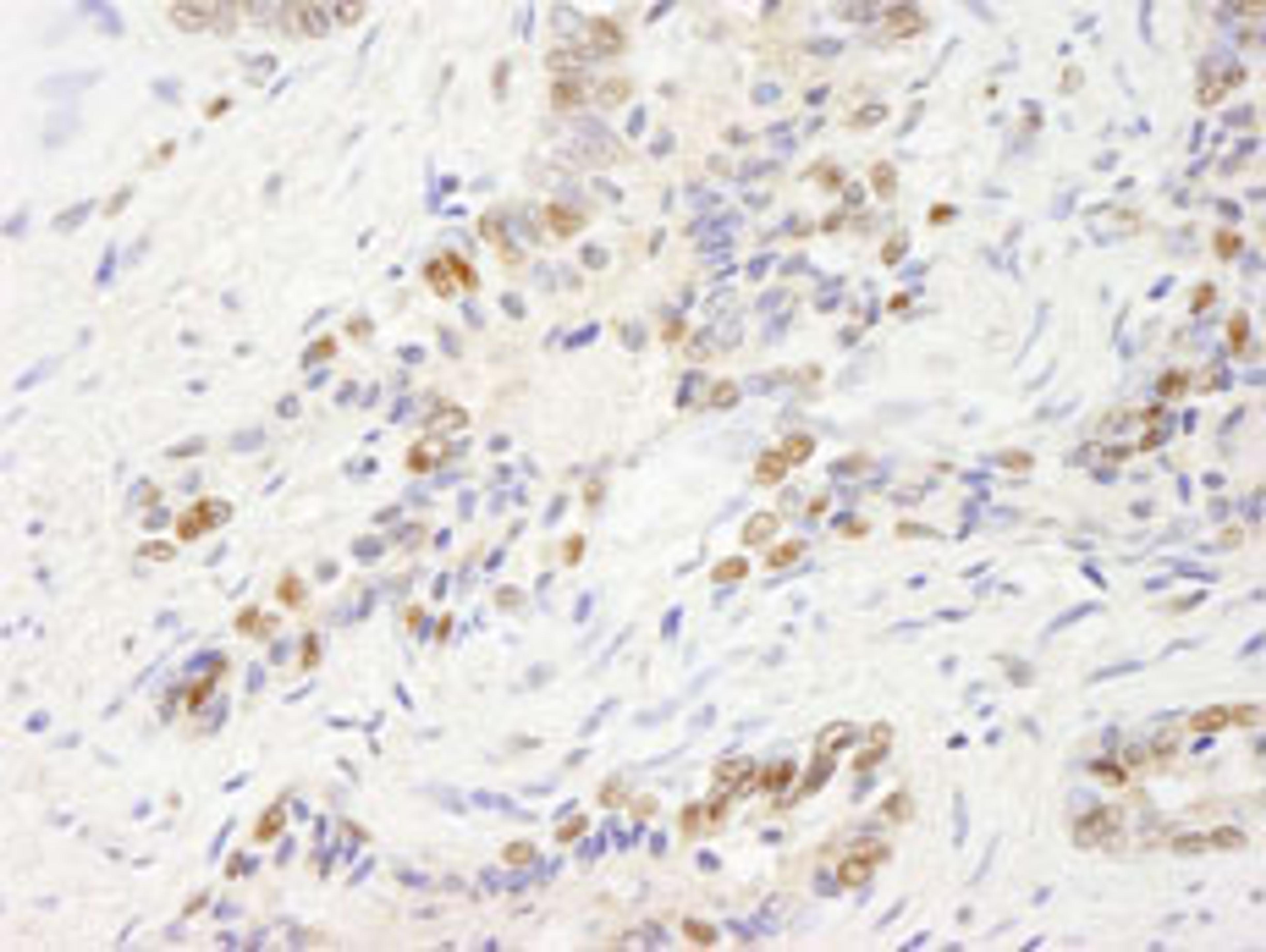 Detection of human UBE1 by immunohistochemistry.