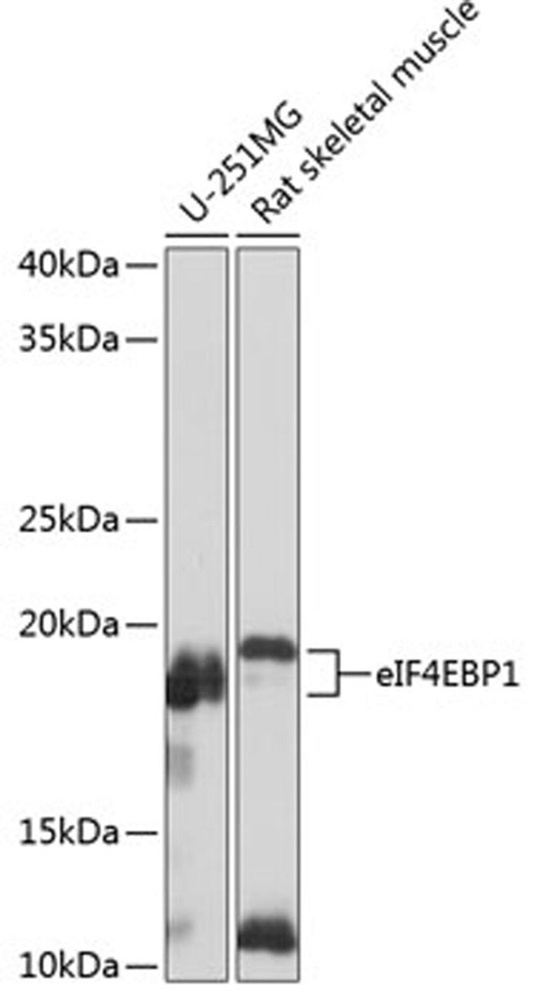 Western blot - eIF4EBP1 antibody (A19045)