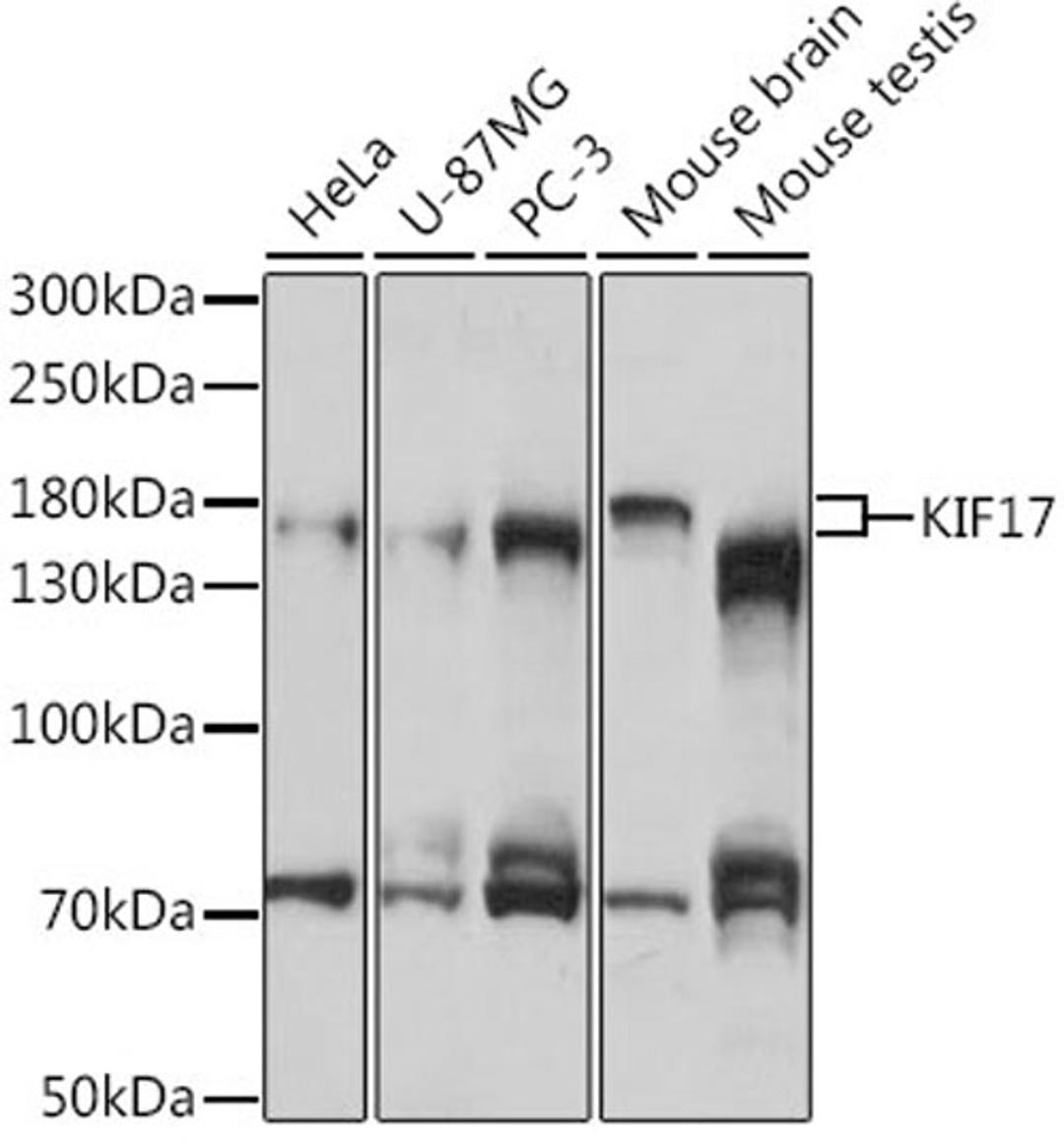 Western blot - KIF17 antibody (A16562)