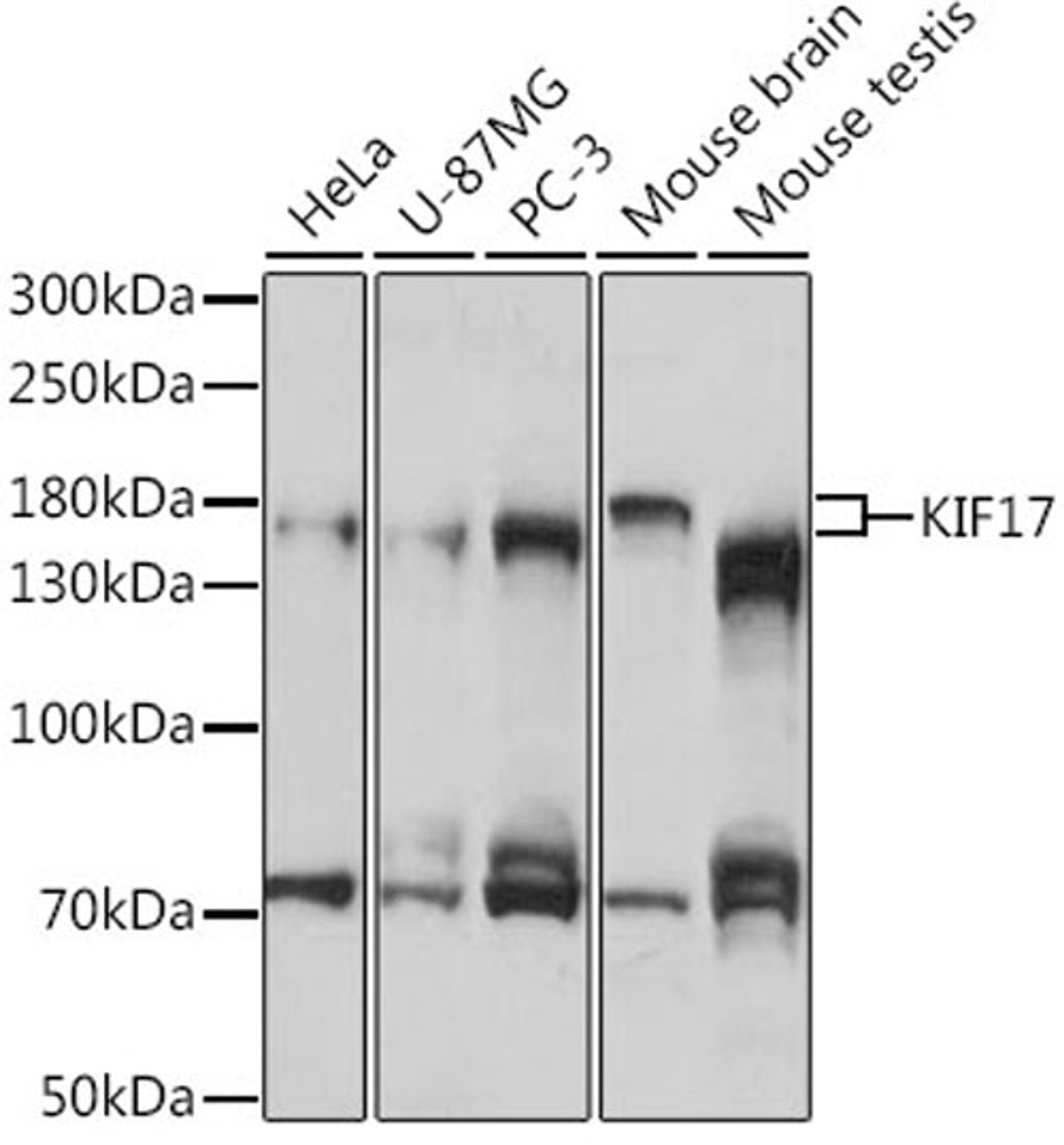 Western blot - KIF17 antibody (A16562)