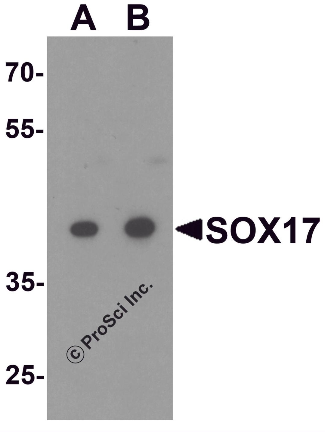Western blot analysis of SOX17 in HepG2 cell lysate with SOX17 antibody at (A) 0.5 and (B) 1 μg/ml.