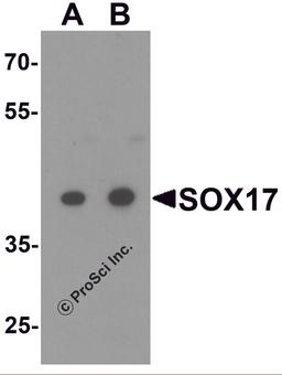 Western blot analysis of SOX17 in HepG2 cell lysate with SOX17 antibody at (A) 0.5 and (B) 1 μg/ml.