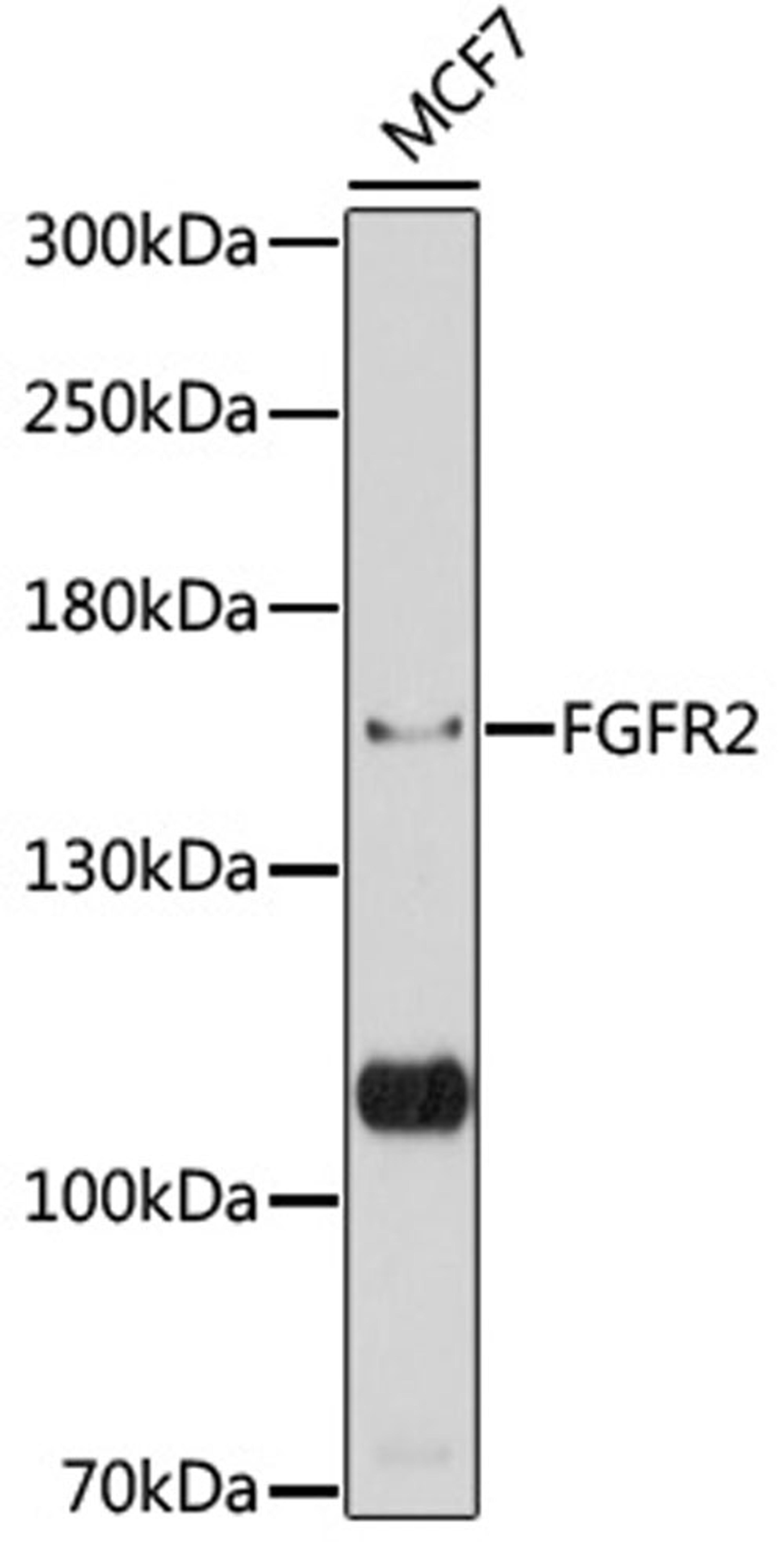 Western blot - FGFR2 antibody (A12436)