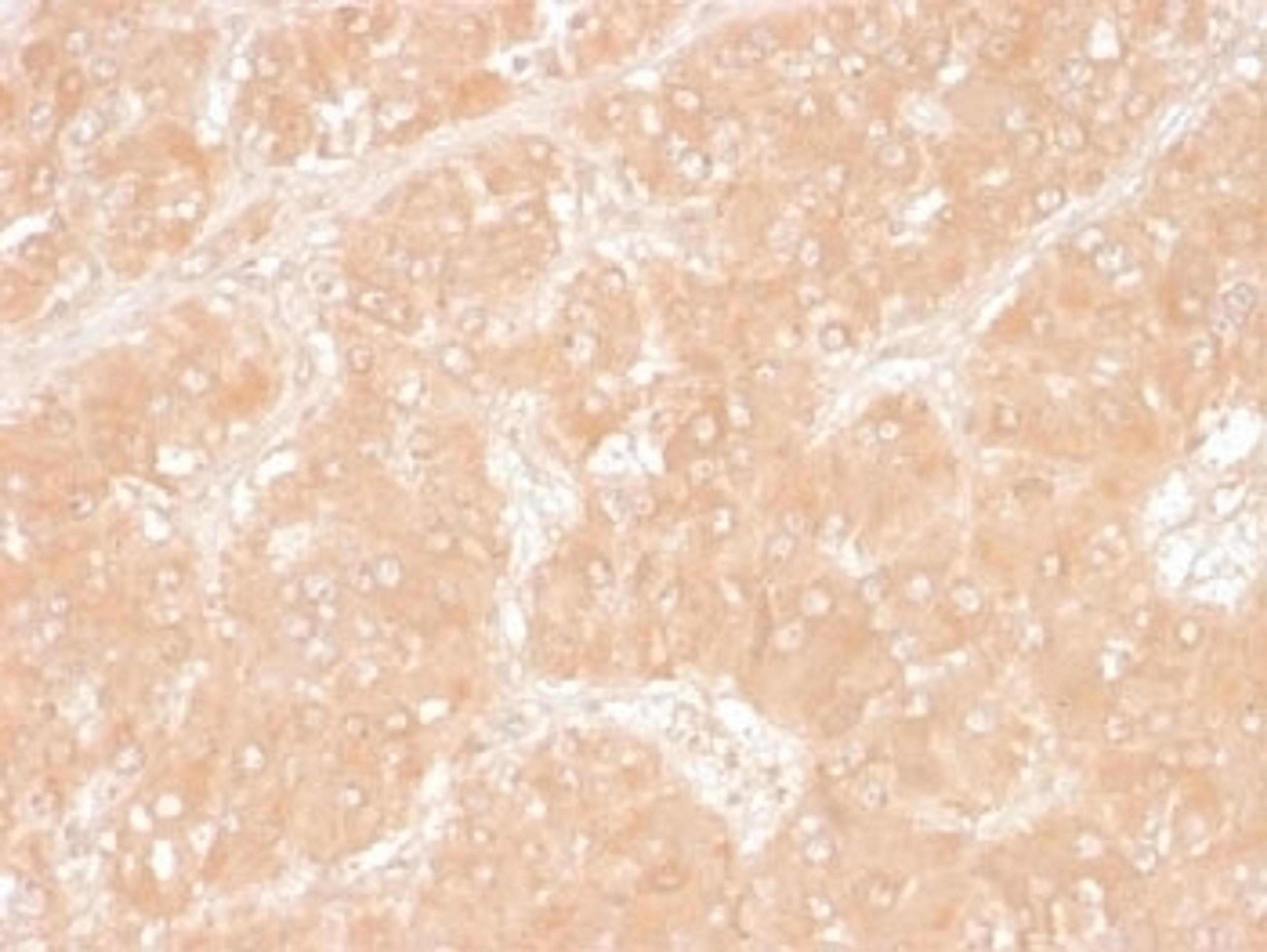 IHC testing of FFPE human adrenal tissue with Perilipin 2 antibody (clone ADFP/1366). Required HIER: steam sections in pH6, 10mM citrate buffer for 10-20 min.