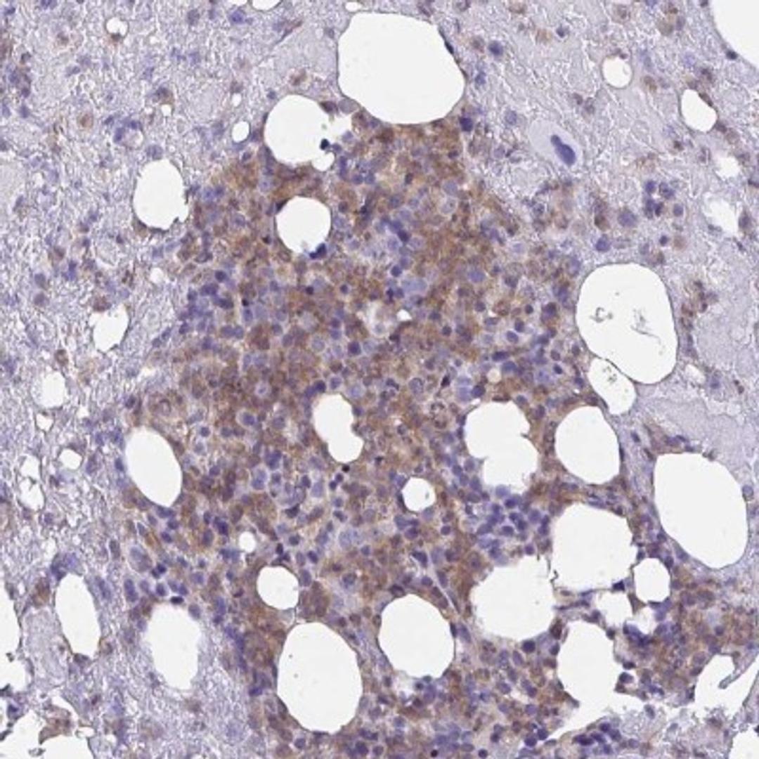 Immunohistochemistry: TNFAIP8 Antibody [NBP2-33814] - Staining of human bone marrow shows moderate cytoplasmic positivity in hematopoietic cells.