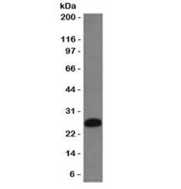 Western blot testing of Ramos cell lysate with CD79 antibody (clone CDLA79a-2).