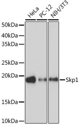 Western blot - Skp1 Rabbit mAb (A9021)