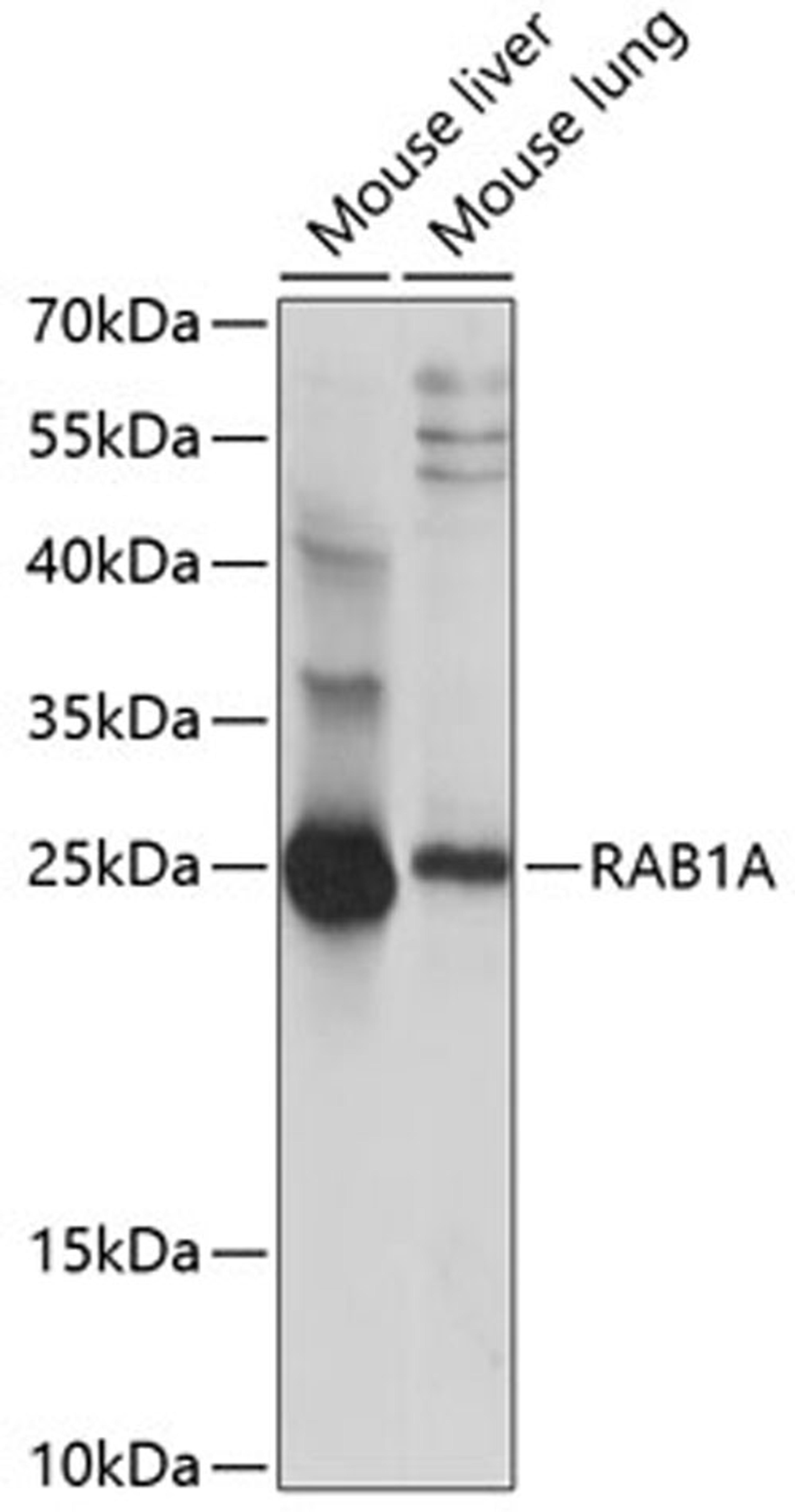 Western blot - RAB1A antibody (A14663)