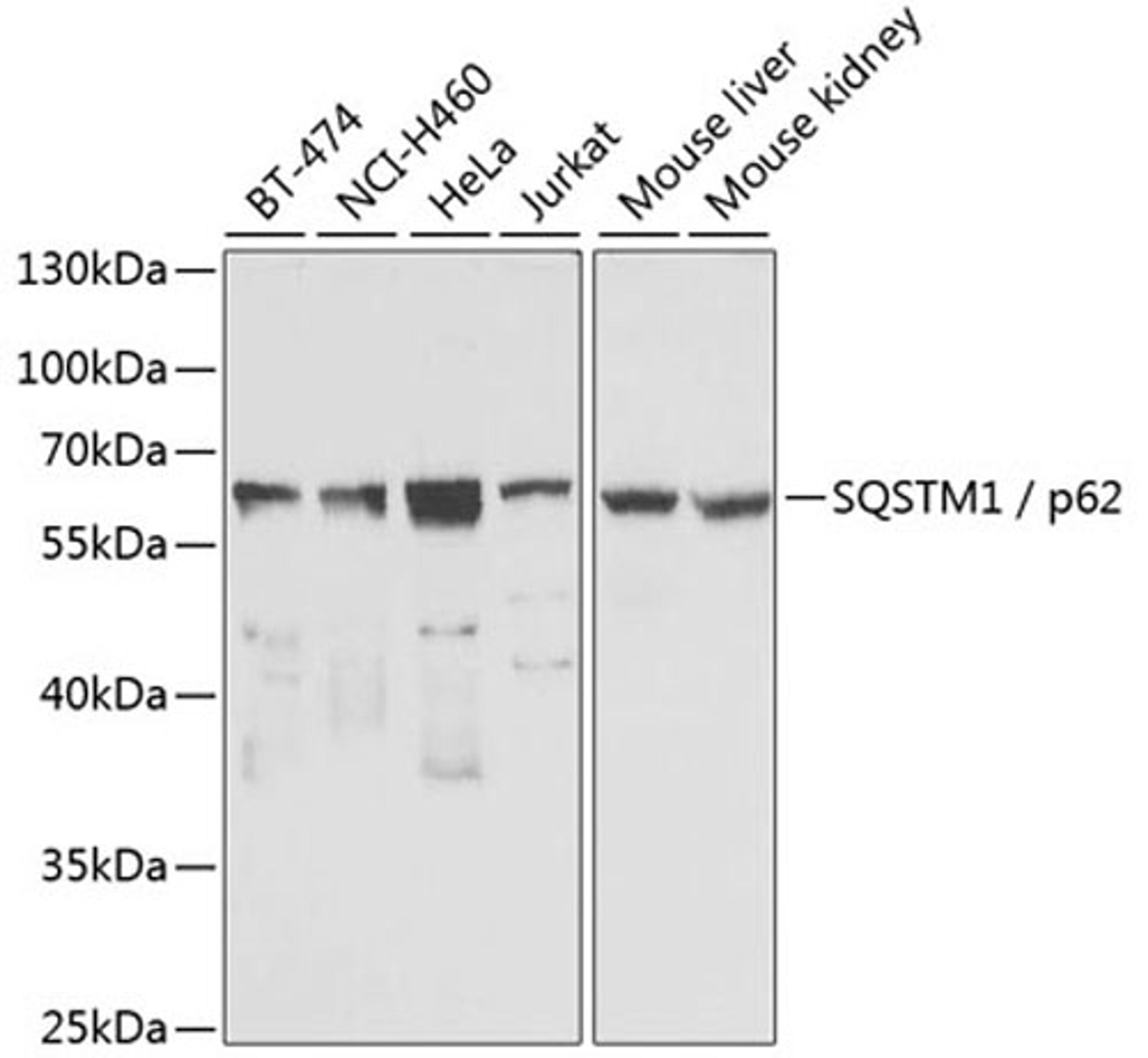 Western blot - SQSTM1 / p62 antibody (A7758)