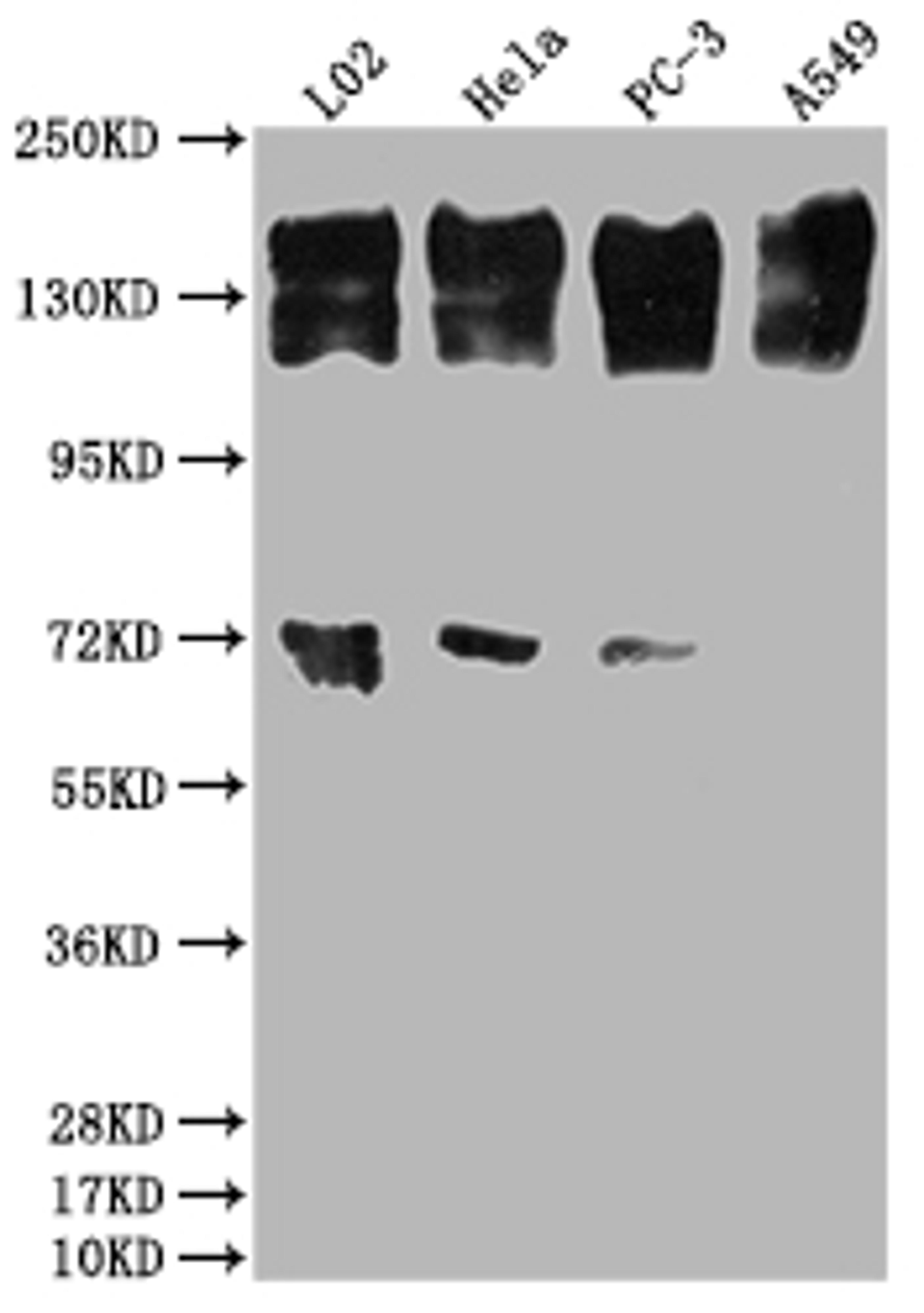 Western Blot. Positive WB detected in: L02 whole cell lysate, Hela whole cell lysate, PC-3 whole cell lysate, A549 whole cell lysate. All lanes: EGFR antibody at 1:2000. Secondary. Goat polyclonal to rabbit IgG at 1/50000 dilution. Predicted band size: 135, 45, 78, 70 kDa. Observed band size: 165 kDa. 
