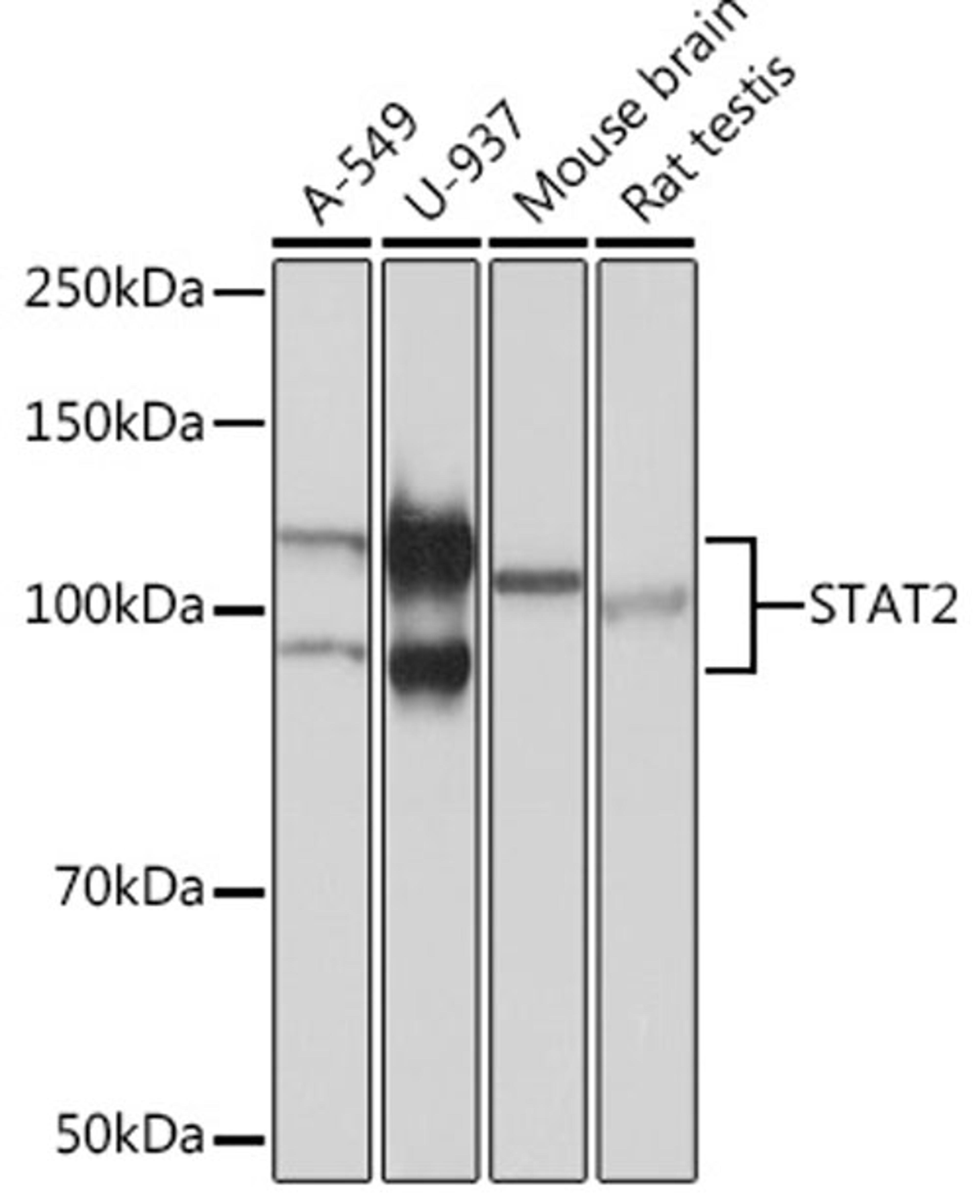 Western blot - STAT2 Rabbit mAb (A3588)