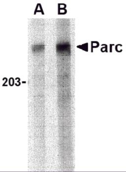 Western blot analysis of PARC in Daudi lysate with PARC antibody at (A) 1 and (B) 2 &#956;g/mL.