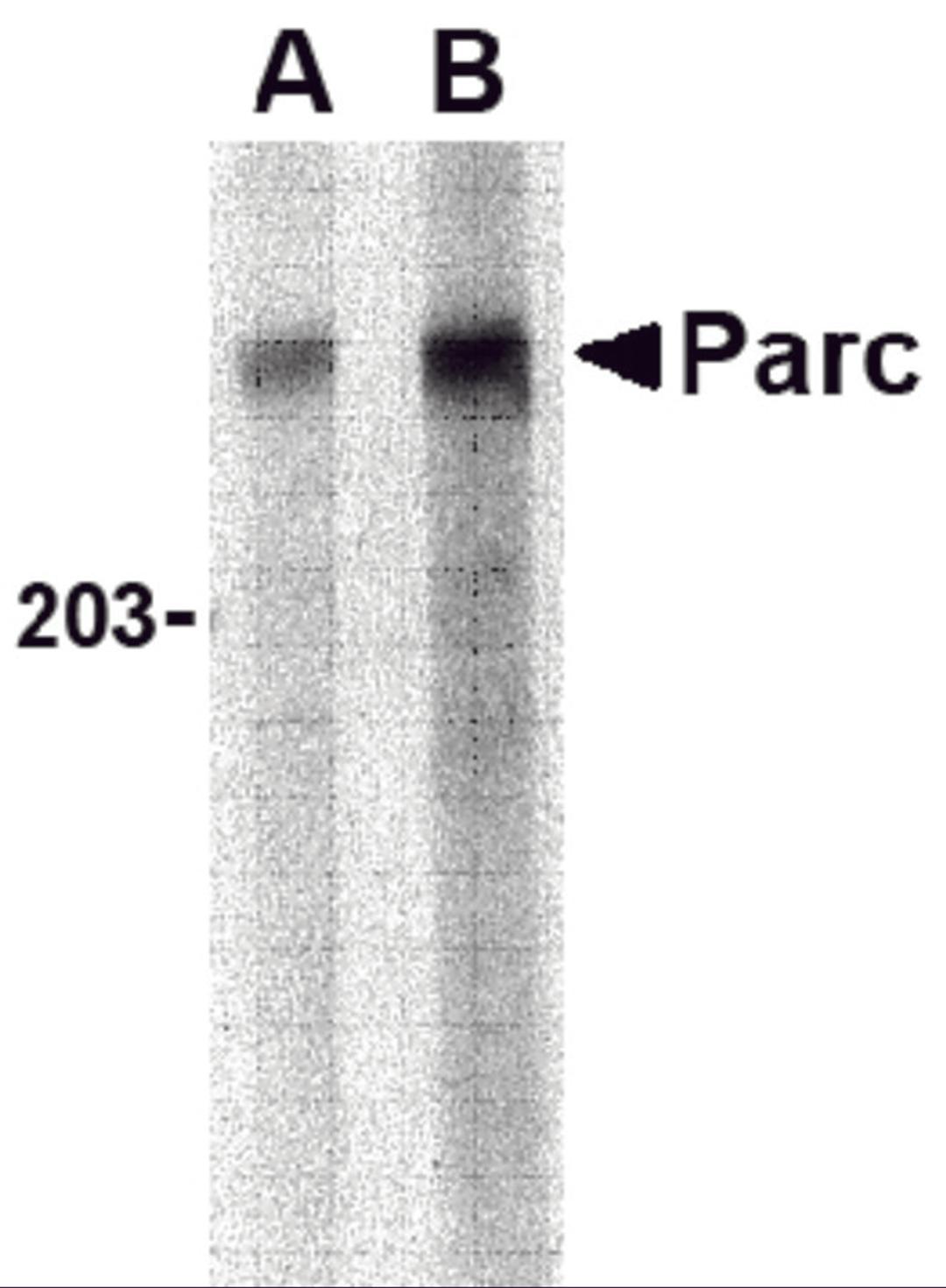 Western blot analysis of PARC in Daudi lysate with PARC antibody at (A) 1 and (B) 2 μg/mL.