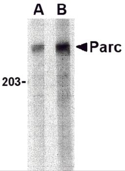 Western blot analysis of PARC in Daudi lysate with PARC antibody at (A) 1 and (B) 2 μg/mL.