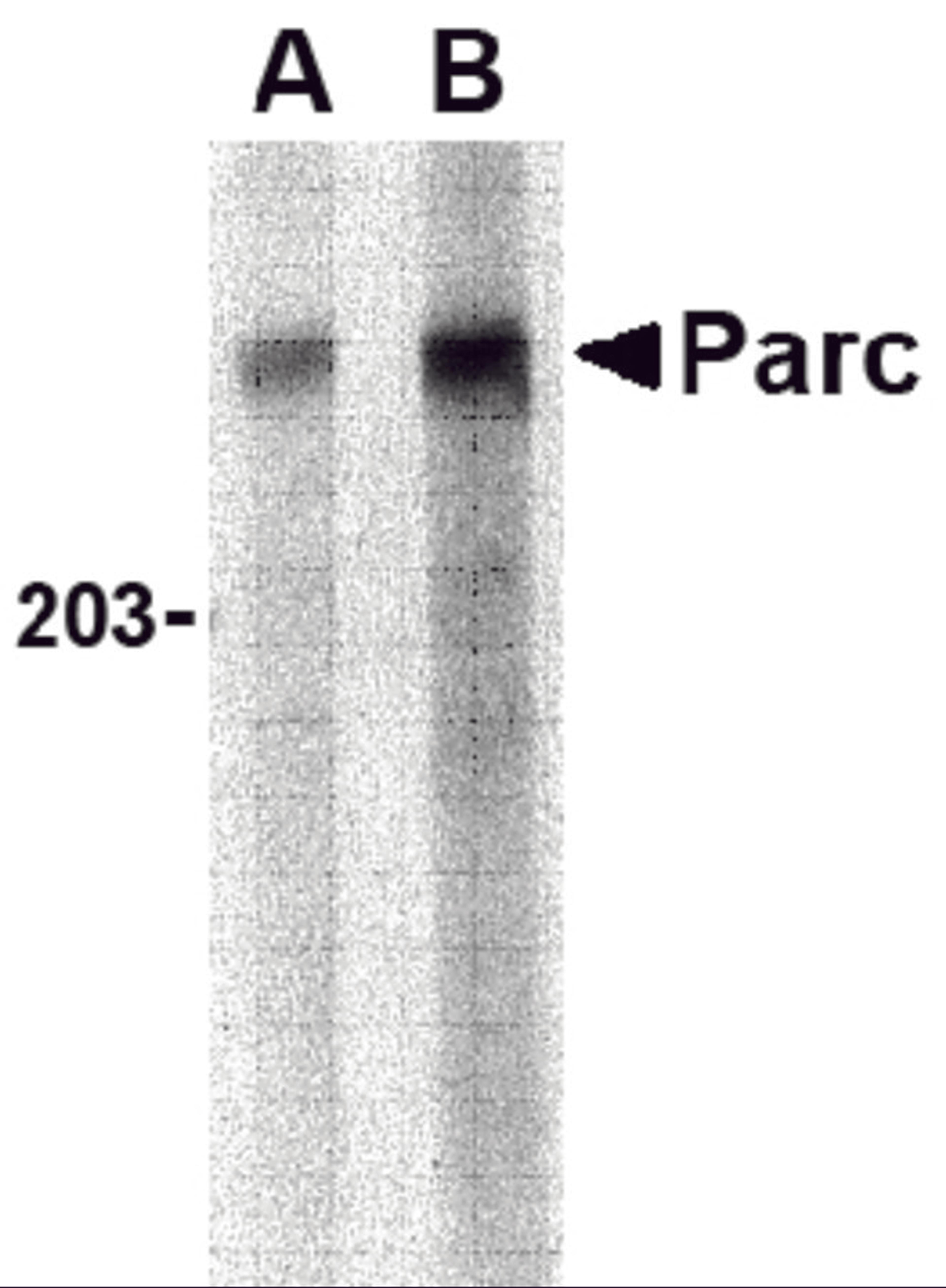 Western blot analysis of PARC in Daudi lysate with PARC antibody at (A) 1 and (B) 2 μg/mL.