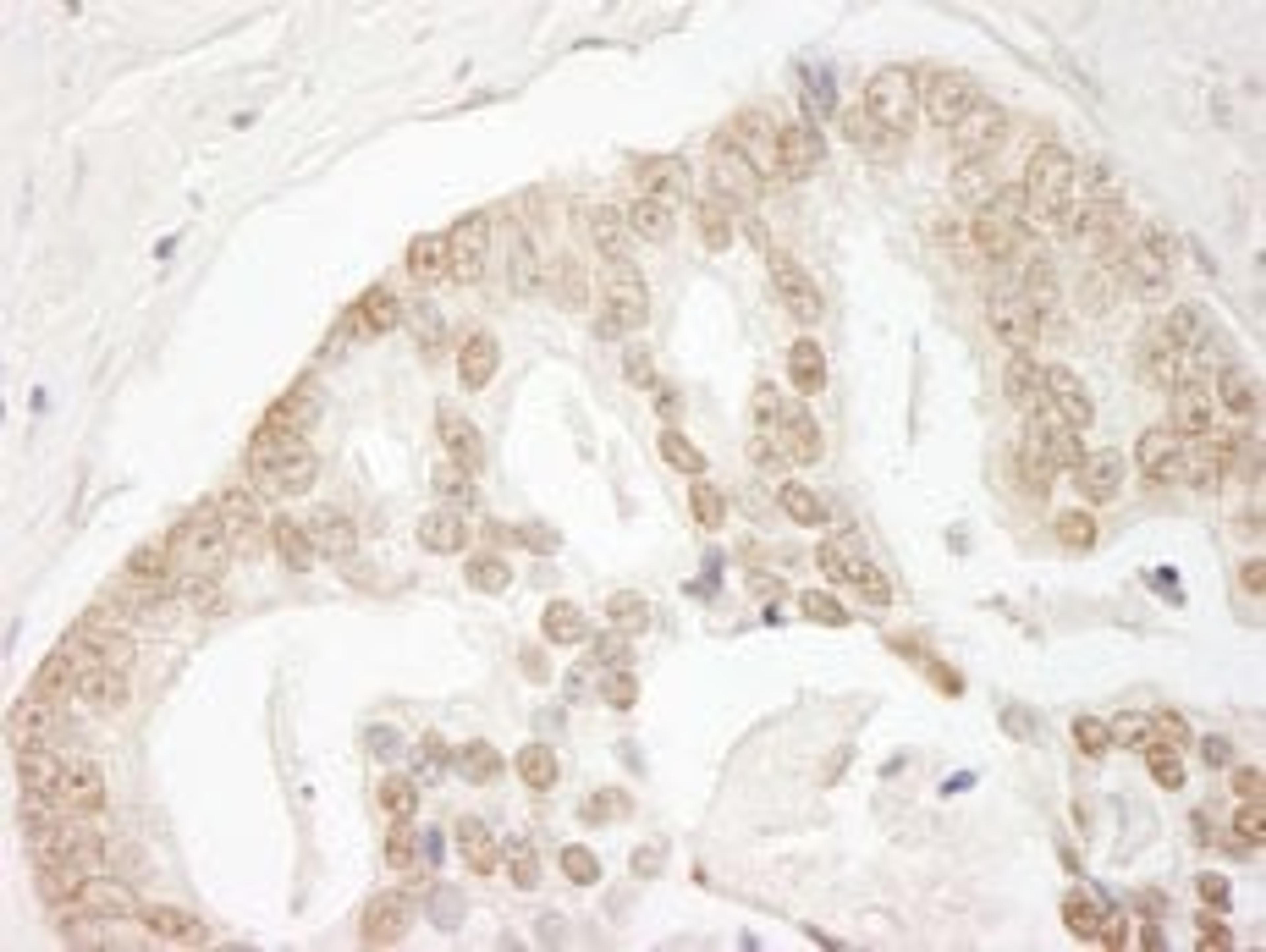 Detection of human GIT2 by immunohistochemistry.