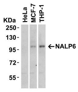 Western blot analysis of NALP6 in HeLa, MCF-7 and THP-1 with NALP6 antibody at 2 μg/mL.