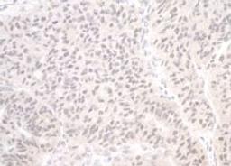 Detection of human PIMT by immunohistochemistry.