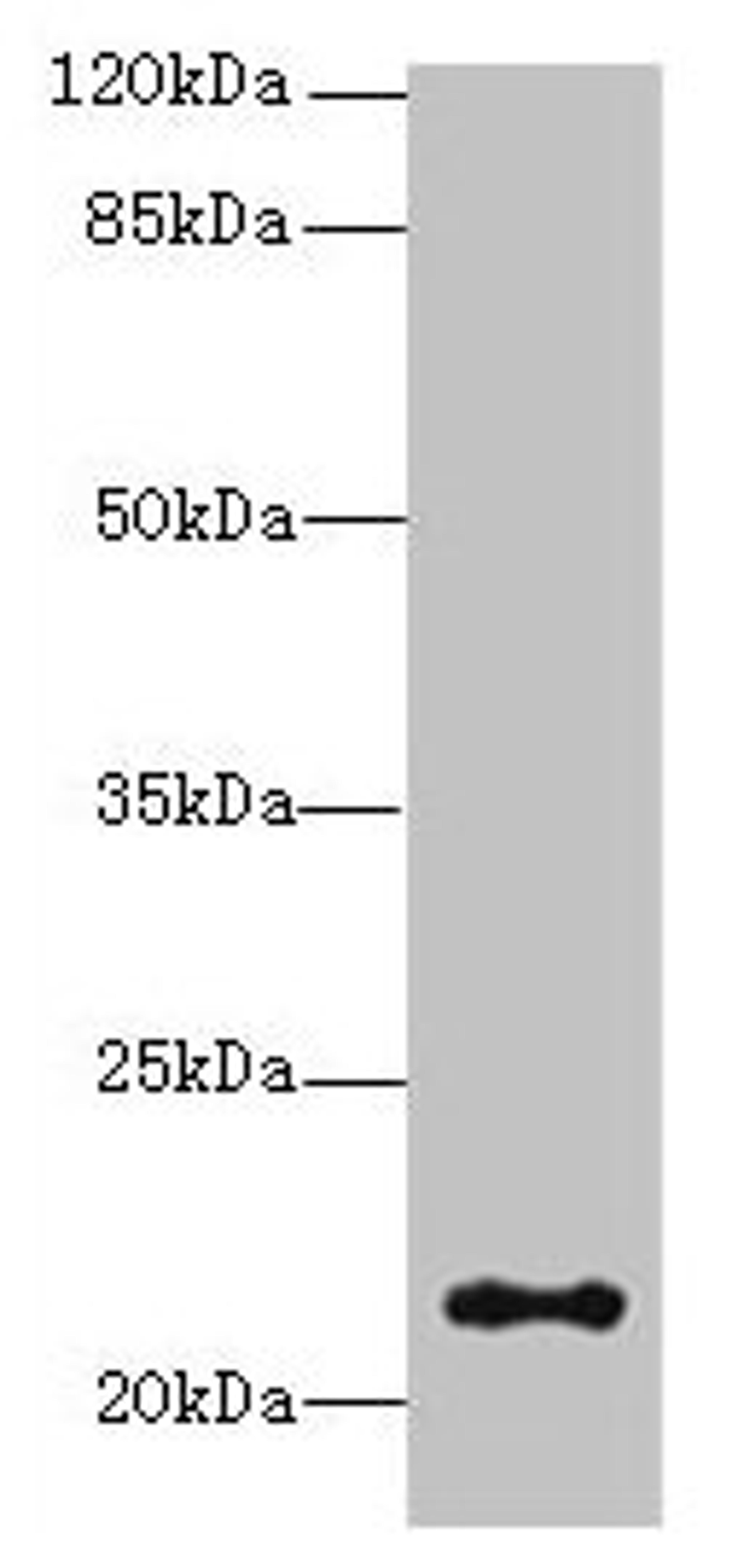 Western blot. All lanes: JAGN1 antibody at 3µg/ml + HL60 whole cell lysate. Secondary. Goat polyclonal to rabbit IgG at 1/10000 dilution. Predicted band size: 22 kDa. Observed band size: 22 kDa