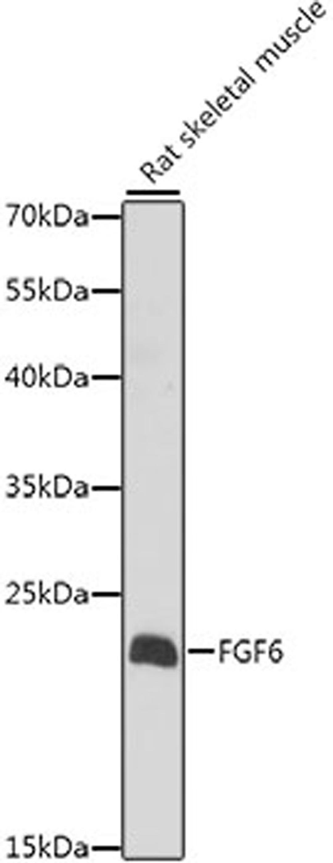 Western blot - FGF6 antibody (A7672)