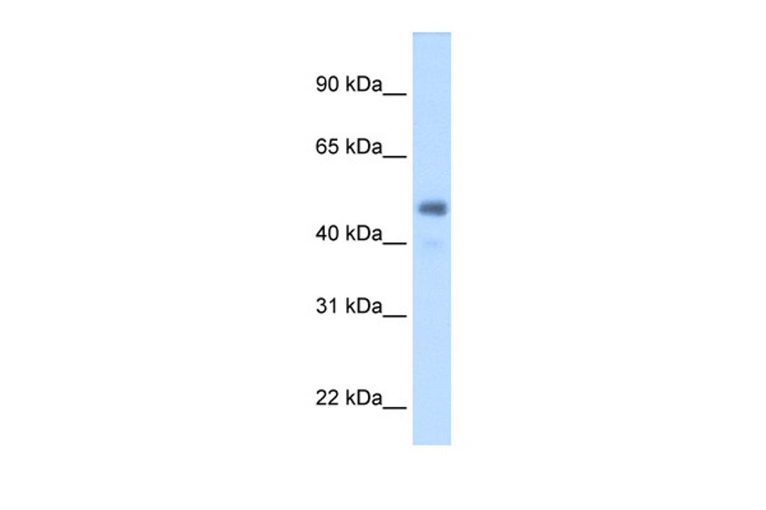 Antibody used in WB on Human Liver at 2.5 ug/ml.