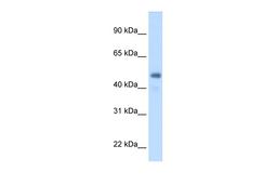 Antibody used in WB on Human Liver at 2.5 ug/ml.