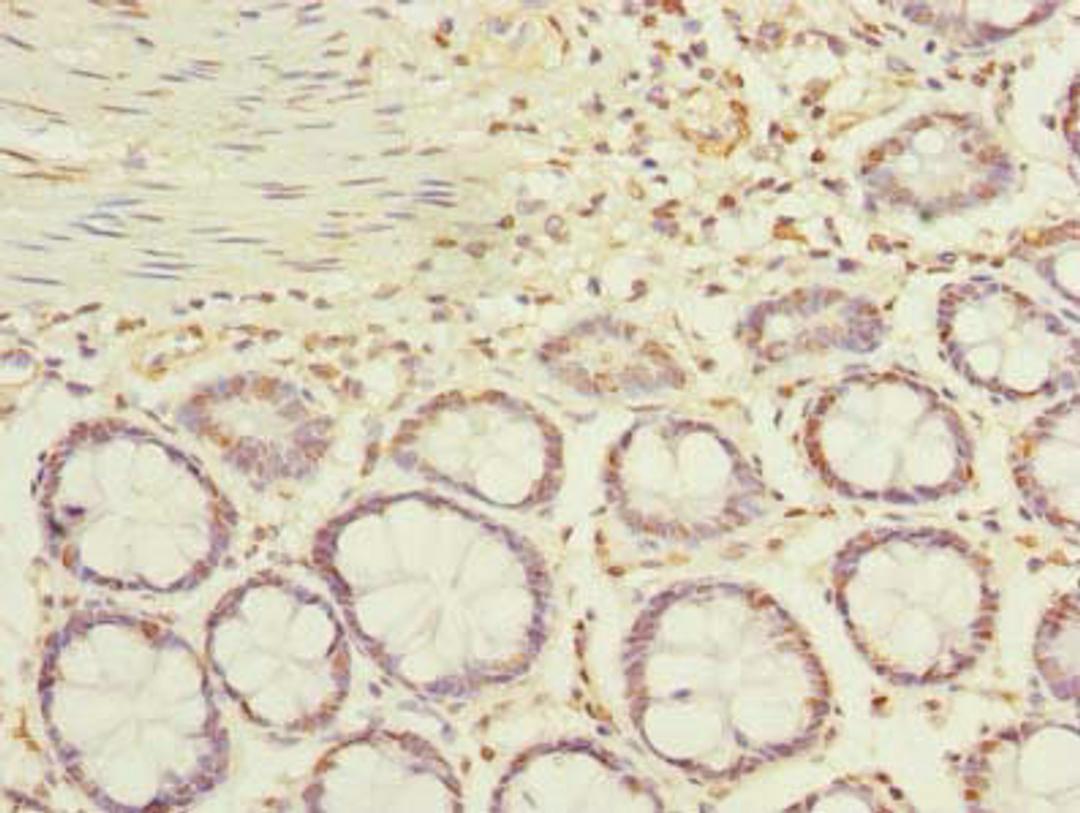 Immunohistochemistry of paraffin-embedded human colon tissue using CSB-PA001255LA01HU at dilution of 1:100