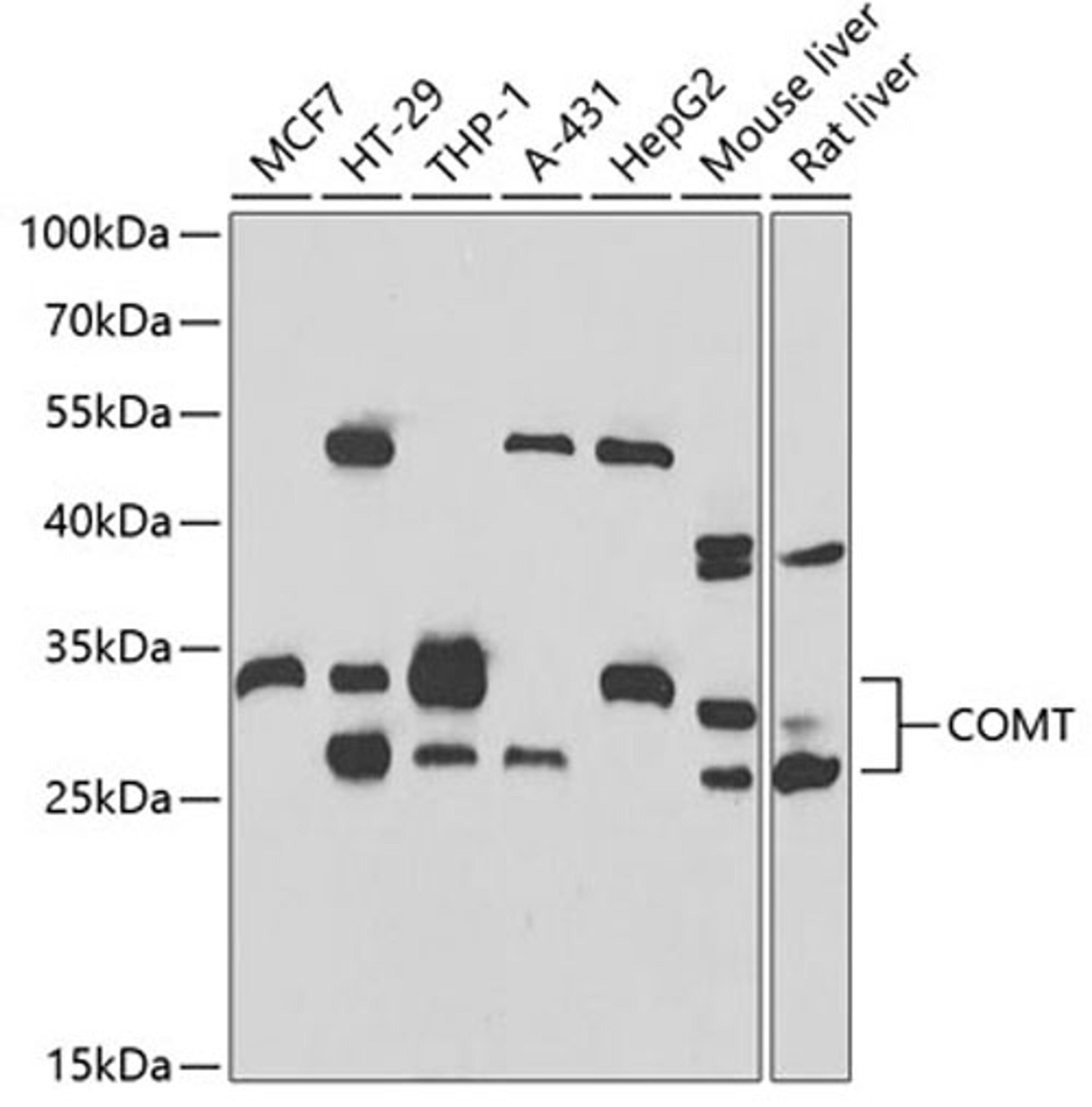 Western blot - COMT antibody (A6200)