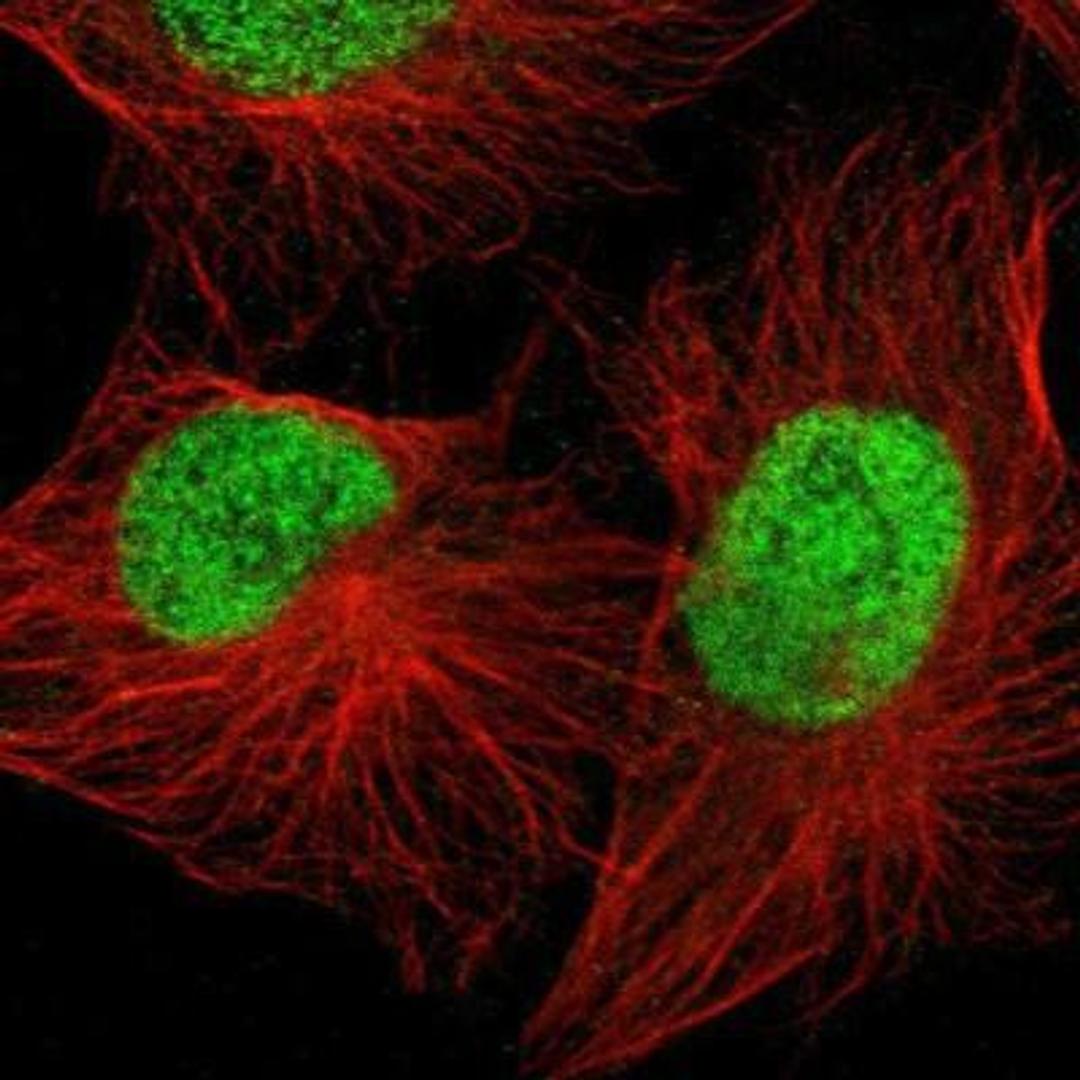 Immunocytochemistry/Immunofluorescence: DACH2 Antibody [NBP1-89476] - Staining of human cell line U-251MG shows positivity in nucleus but not nucleoli.