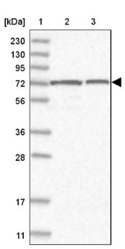 Western Blot: SLC12A8 Antibody [NBP1-86585] - Lane 1: Marker [kDa] 230, 130, 95, 72, 56, 36, 28, 17, 11<br/>Lane 2: Human cell line RT-4<br/>Lane 3: Human cell line U-251MG sp