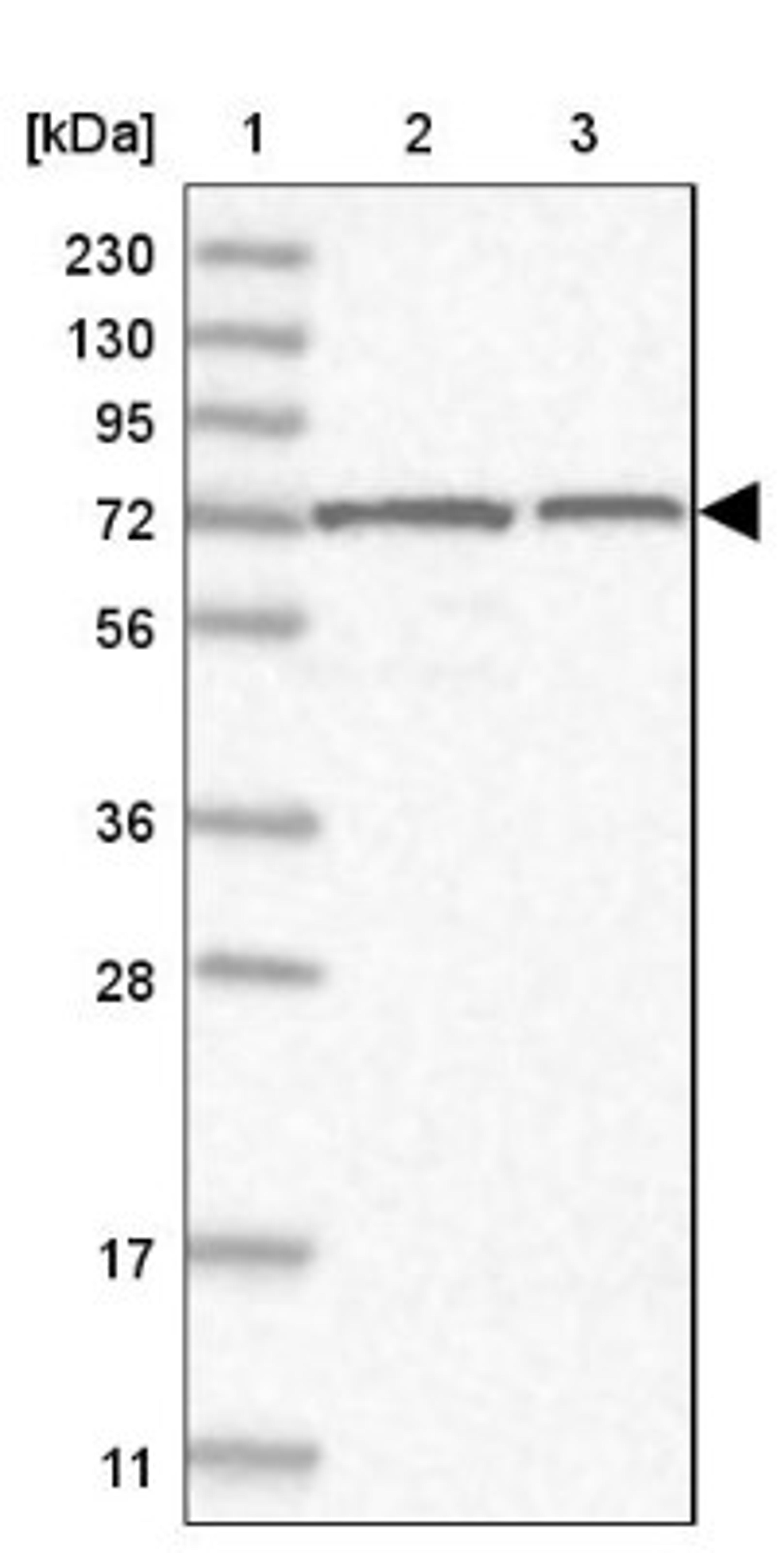 Western Blot: SLC12A8 Antibody [NBP1-86585] - Lane 1: Marker [kDa] 230, 130, 95, 72, 56, 36, 28, 17, 11<br/>Lane 2: Human cell line RT-4<br/>Lane 3: Human cell line U-251MG sp