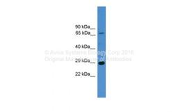 Antibody used in WB on Human HEK293T at 0.1 - 1  ug/ml.