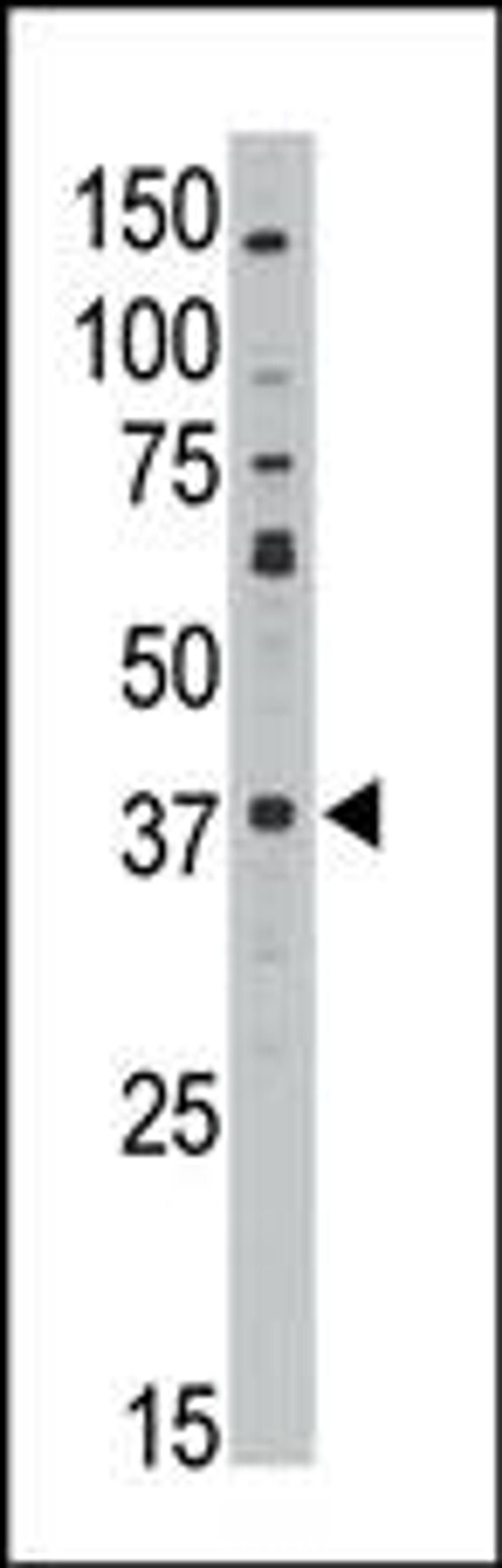 Antibody is used in Western blot to detect MAGEA10 in HL60 lysate.