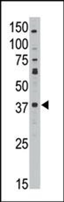 Antibody is used in Western blot to detect MAGEA10 in HL60 lysate.