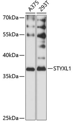 Western blot - STYXL1 antibody (A12850)