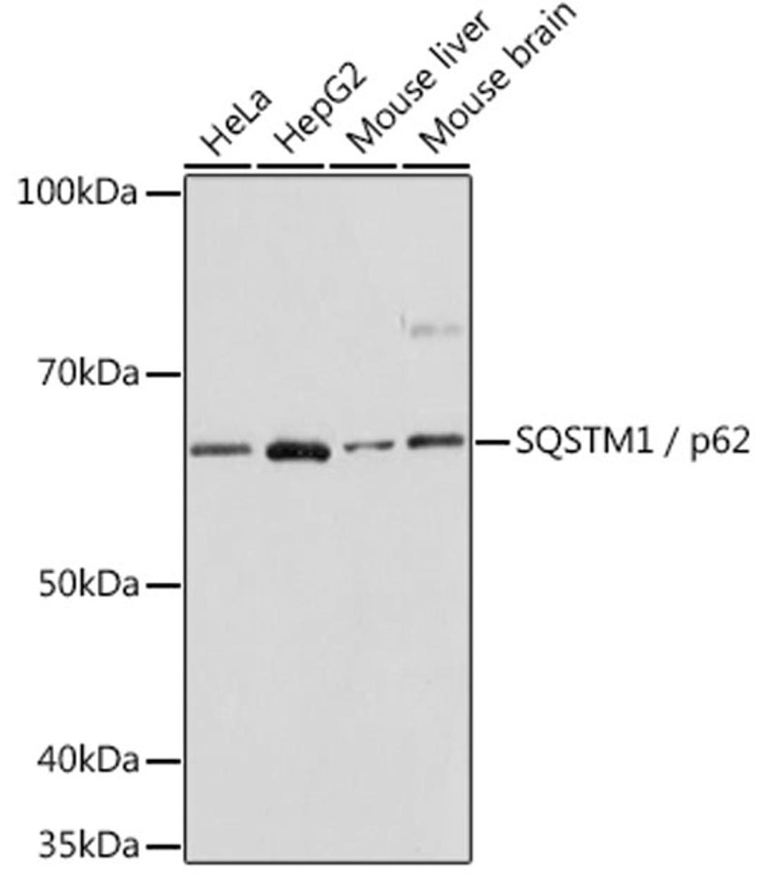 Western blot - SQSTM1 / p62 antibody (A19700)