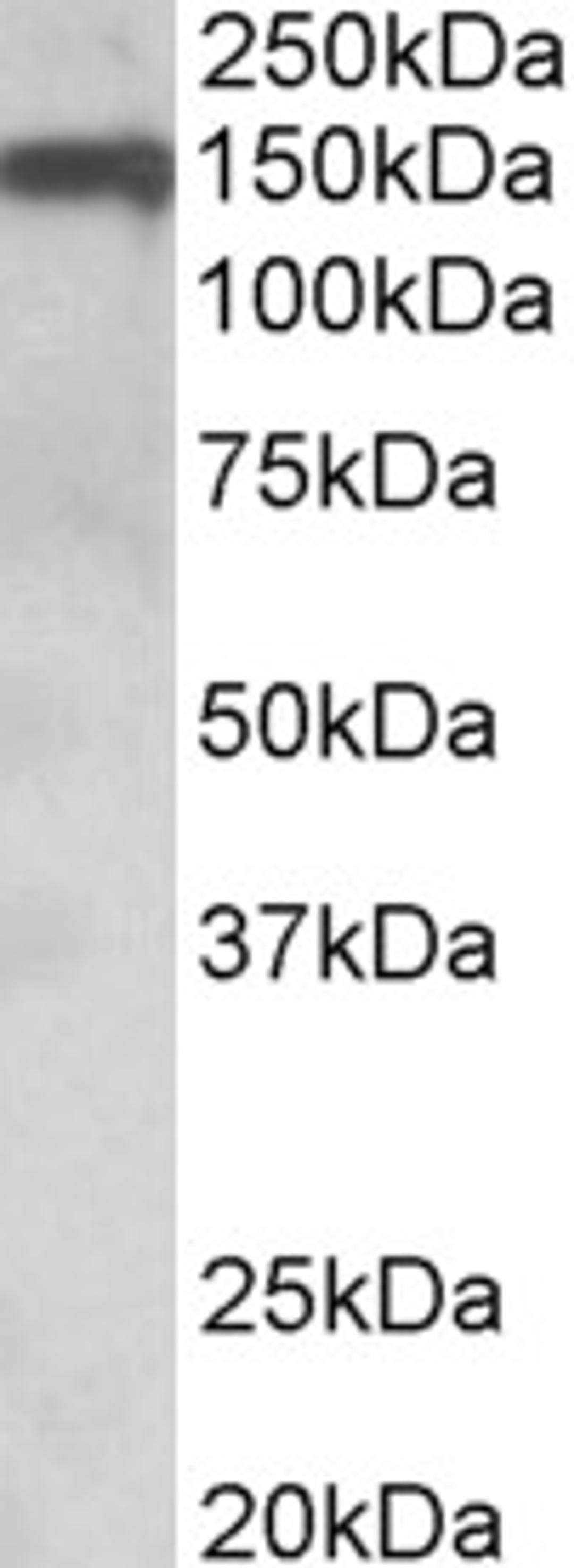 45-999 (0.1ug/ml) staining of Human Amygdala lysate (35ug protein in RIPA buffer). Primary incubation was 1 hour. Detected by chemiluminescence.