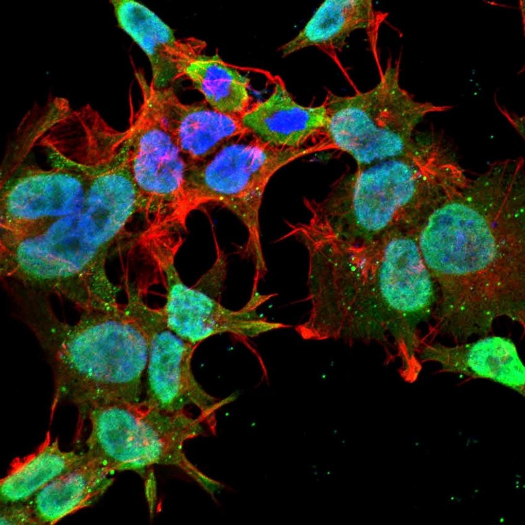 Immunofluorescence analysis of neuroblastoma cell line sk-n-be using FIG4 antibody