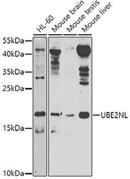 Western blot - UBE2NL antibody (A8381)